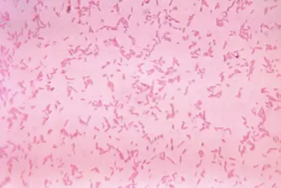 Study: We're losing the fight against drug-resistant infections faster we'd thought