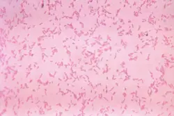 Study: We're losing the fight against drug-resistant infections faster we'd thought